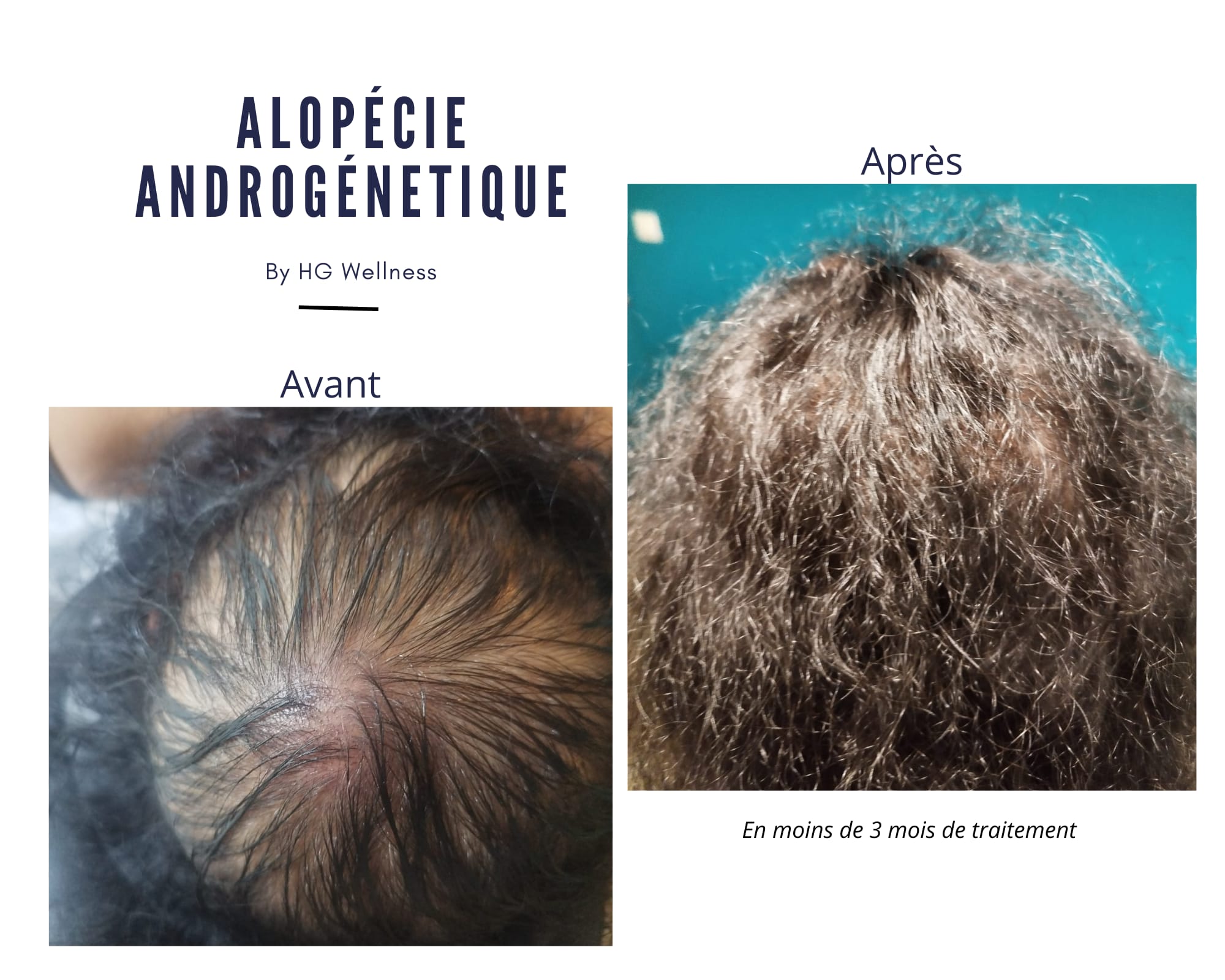 Pack Complet HG Wellness Shop